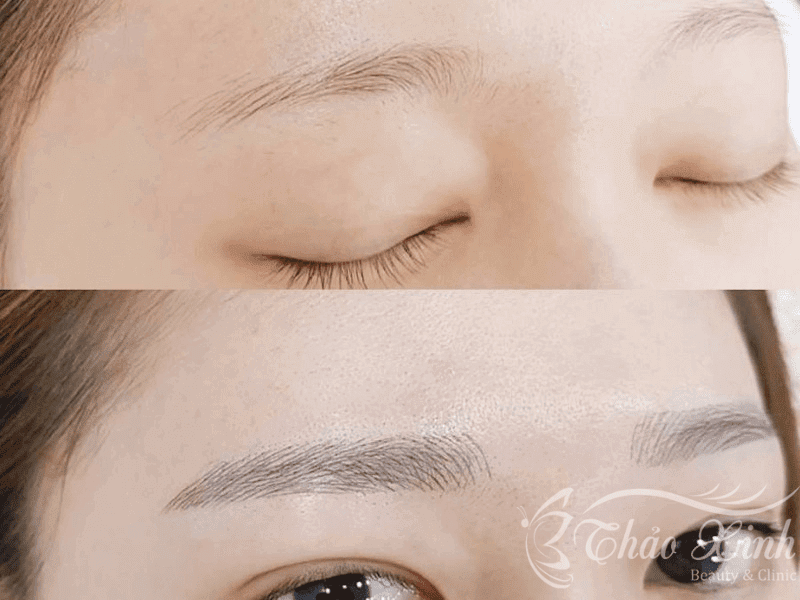 Hậu quả điêu khắc lông mày