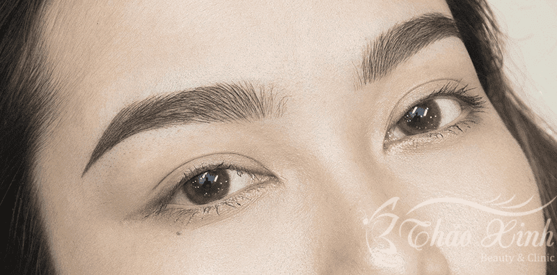 Hậu quả điêu khắc lông mày