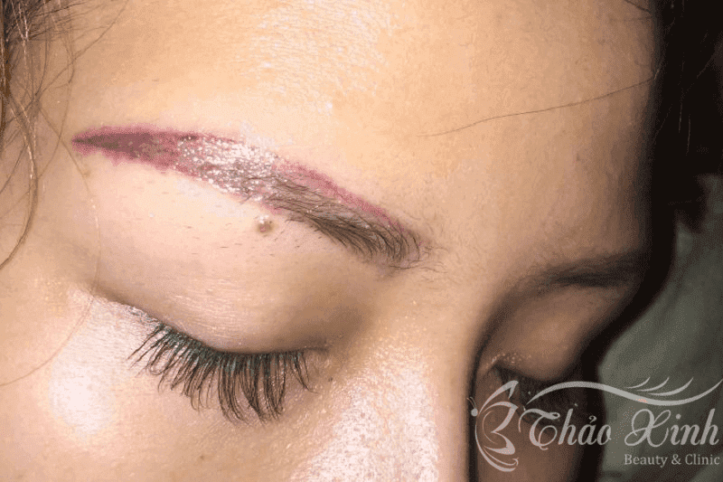 Hậu quả điêu khắc lông mày