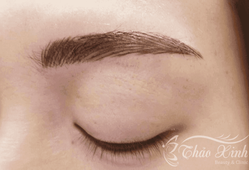 Hậu quả điêu khắc lông mày