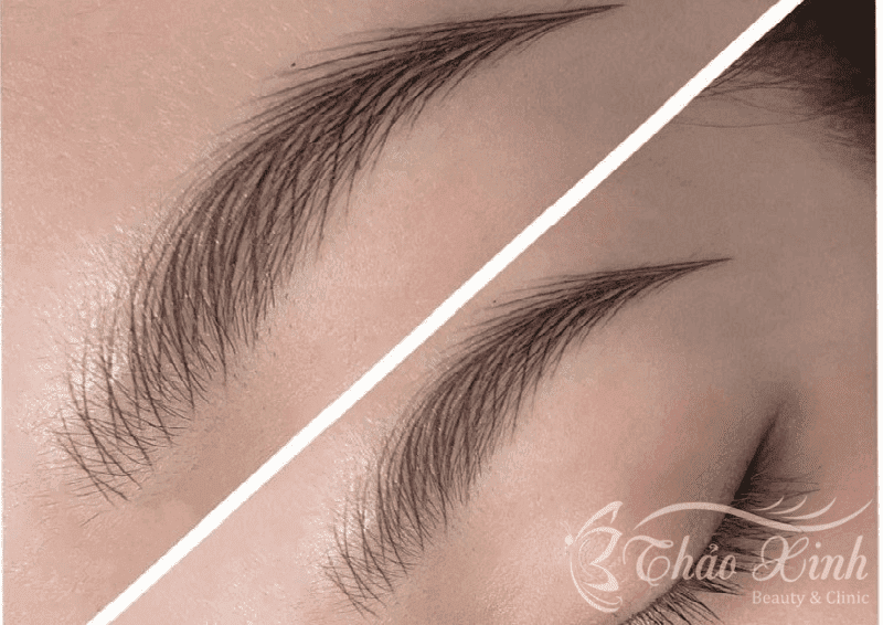 Hậu quả điêu khắc lông mày