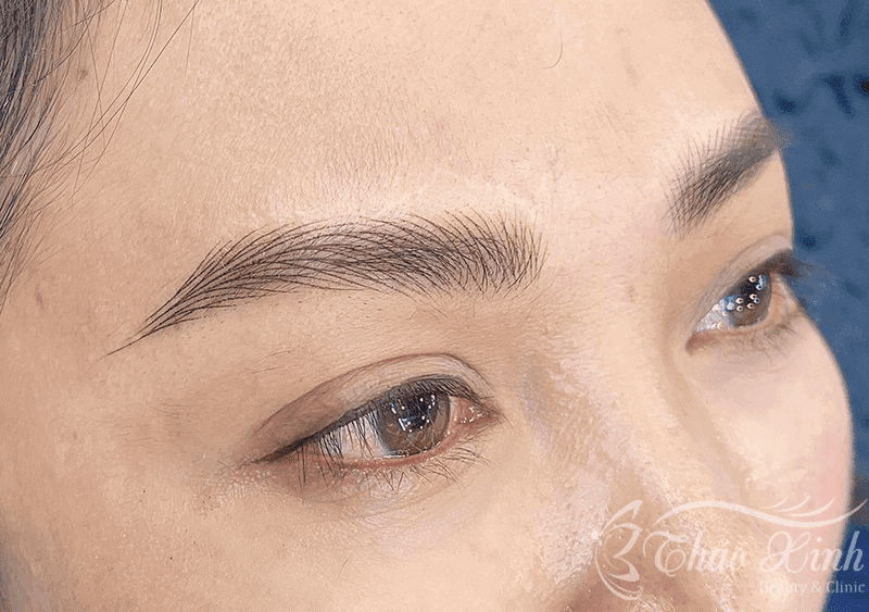 Ngứa lông mày sau khi điêu khắc