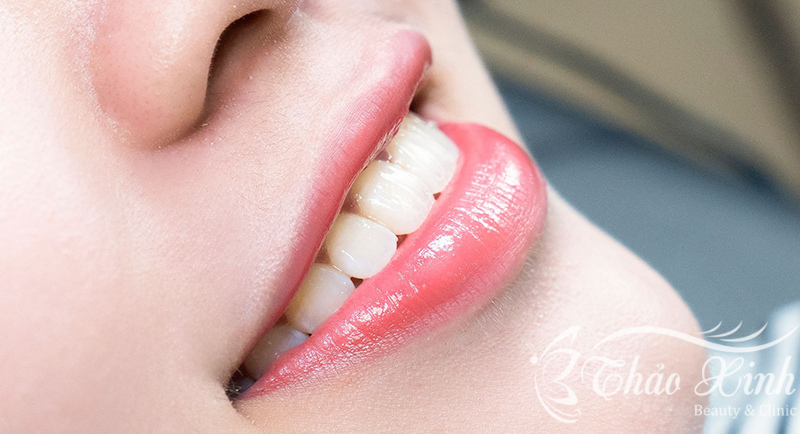 Phun môi ombre giải pháp làm đẹp an toàn và thời thượng - Hottrend 2023 28 Phun môi ombre