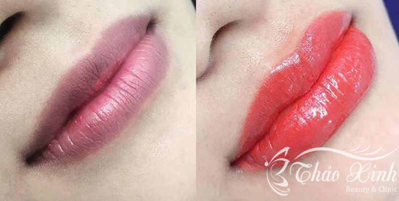 Phun môi ombre giải pháp làm đẹp an toàn và thời thượng - Hottrend 2023 29 Phun môi ombre