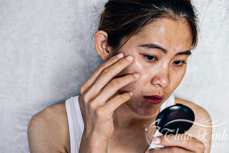 Tắm trắng phi thuyền