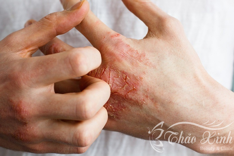 Tắm trắng phi thuyền