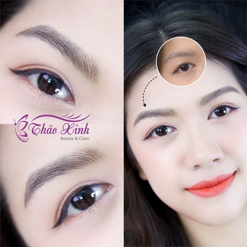 Nhược điểm của Hairstroke