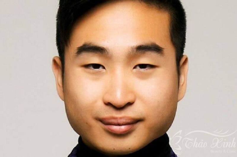 Lông mày ngắn
