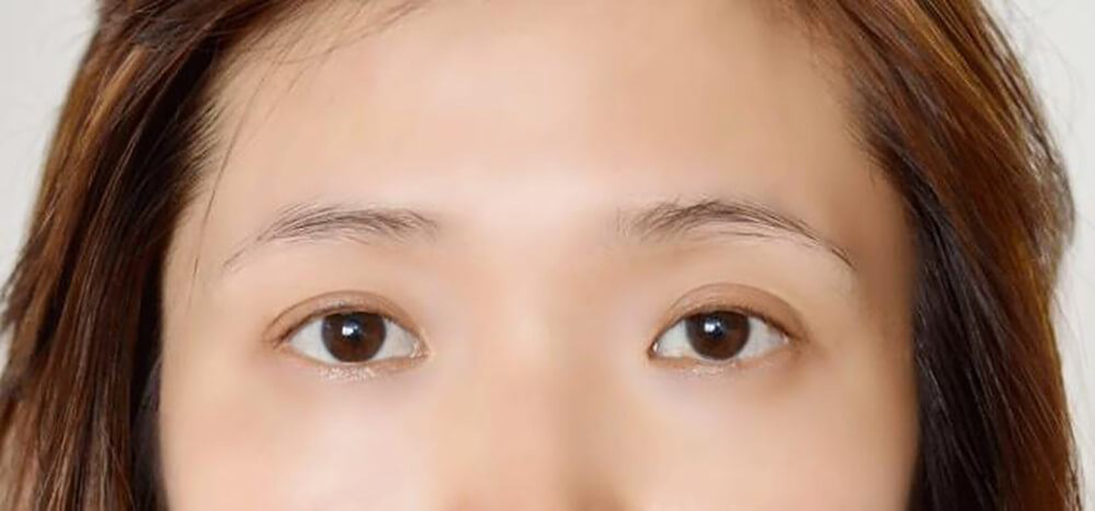 Lông mày thưa