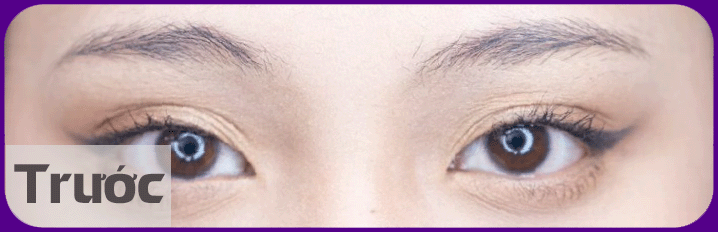 chan may khong can xung truoc