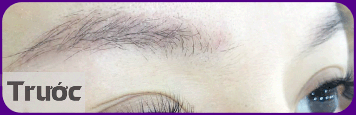 long may moc nguoc truoc