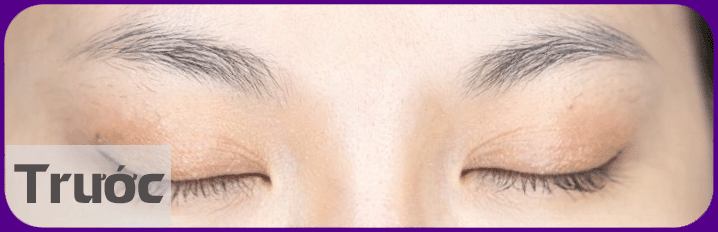 long may ngan thieu duoi truoc