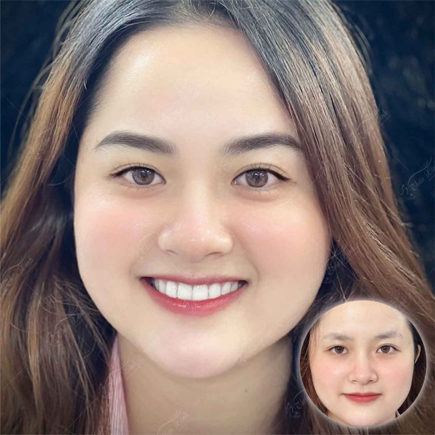 img-heading-section-1